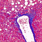 Gomori Trichrome Stain