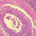 Hematoxylin Gill 3X