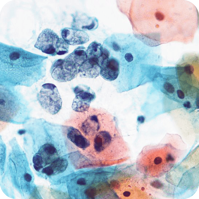 Papanicolaou Stain EA-50, 1 gal, ADI